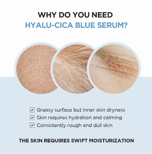 SKIN1004 Madagascar Centella Hyalu-Cica Blue Serum 50ml